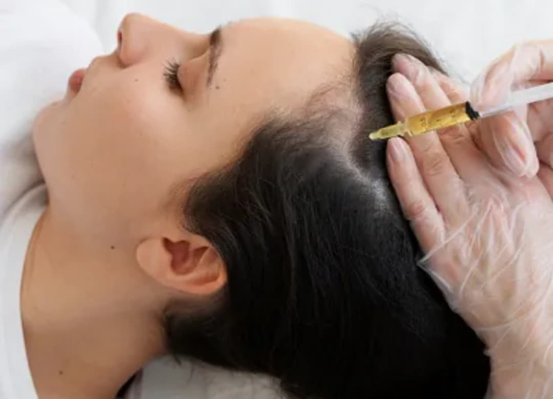 Prp therapy