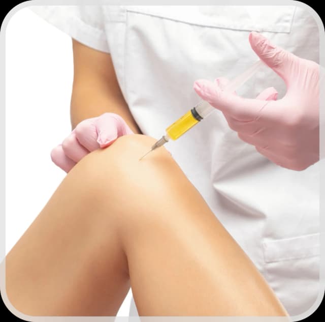 PRP Therapy