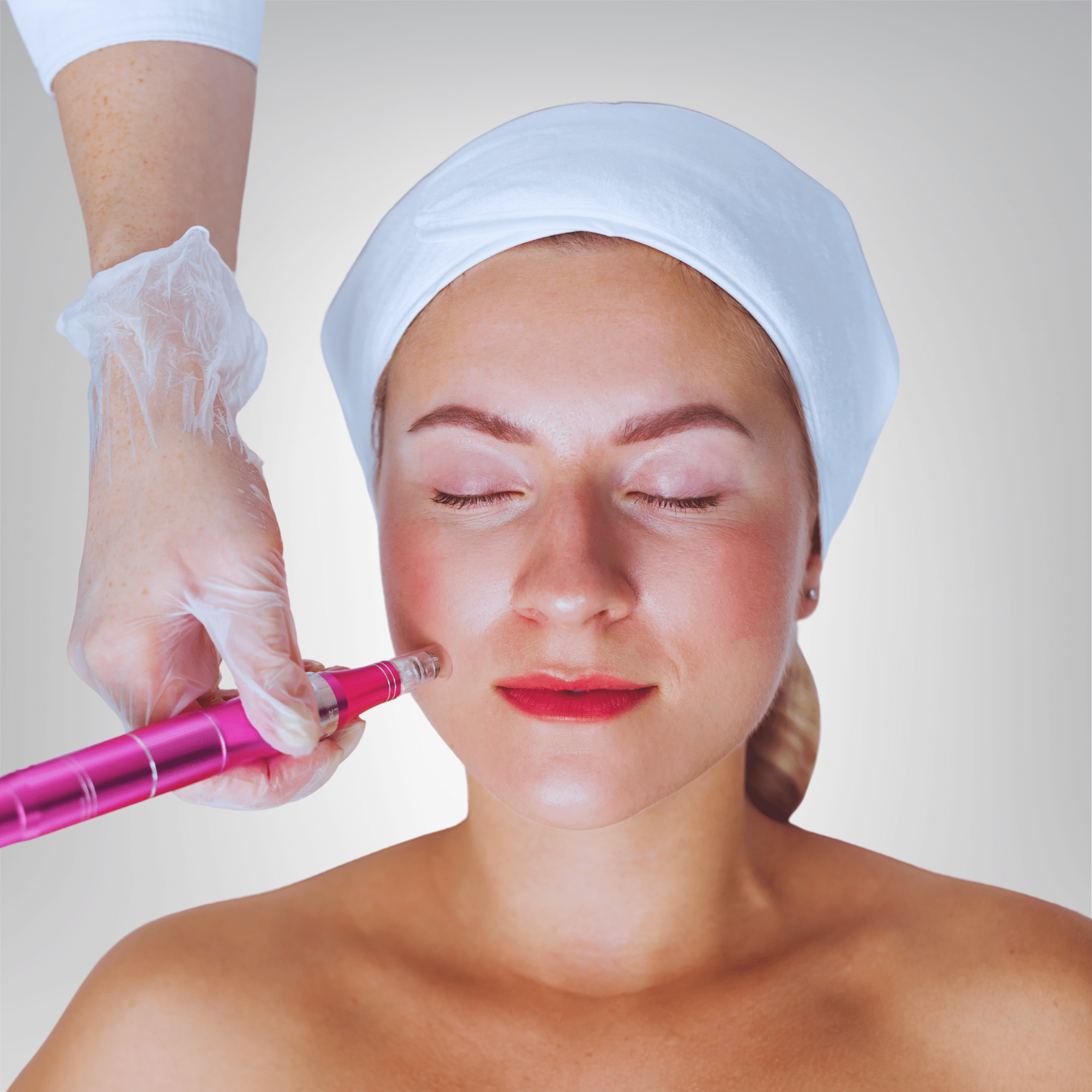 vampire facial prp therapy